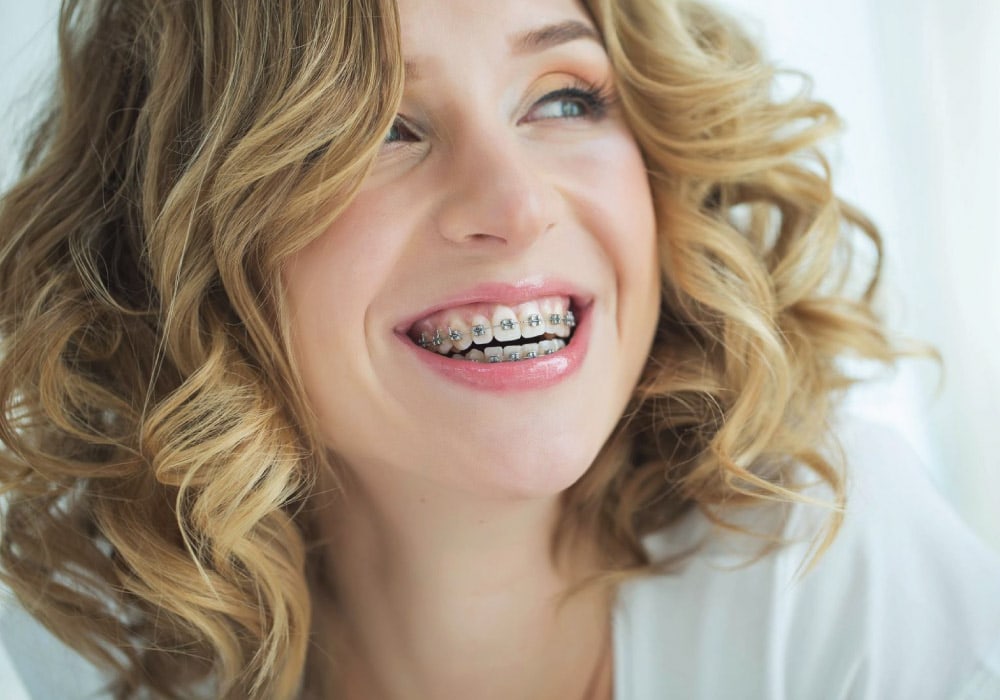 crescent dental and orthodontics lockhart seguin san marcos tx services braces and orthodontics image